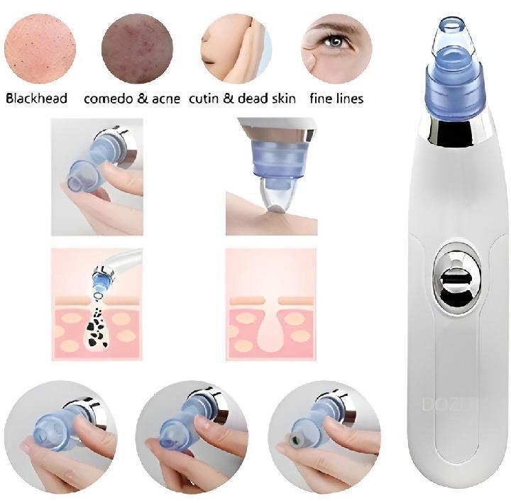 Suitable For Sensitive Skin Derma Suction Facial Cleanser